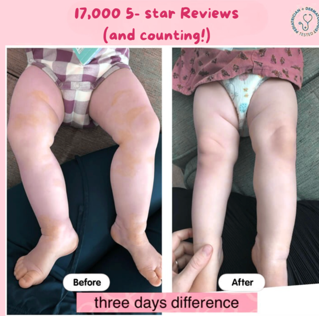 Eczema Beef Tallow Balm